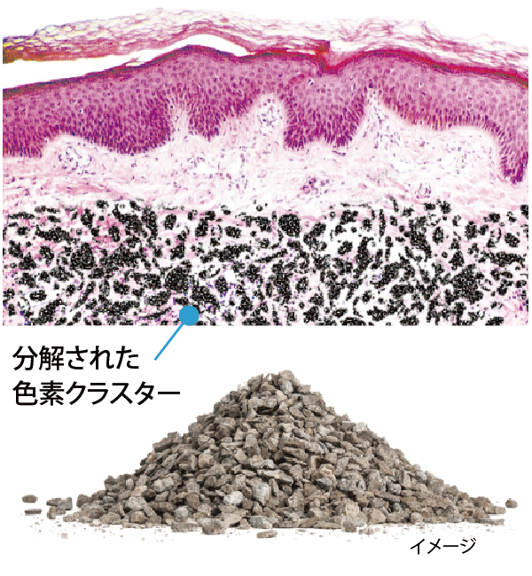 色素クラスター分解のイメージ2